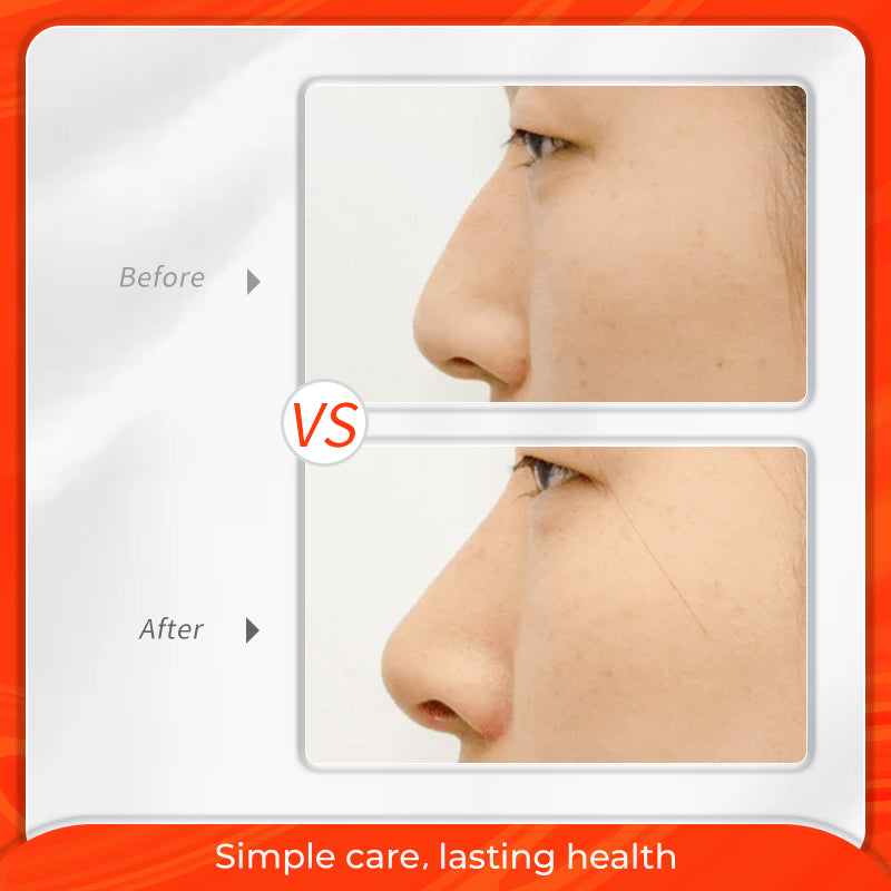 MeiYanQiong Nano Gold Nose Beautiful Essence Shaping Upright Nose